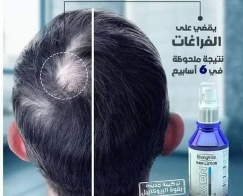 Strongville Hair Loss Lotion for Men 100 ml - Strongville